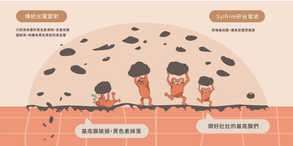 矽谷電波效果1. 修補基底膜 