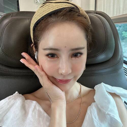 案例心得 2｜改善眼皮下垂，連雙眼皮貼都不用了 